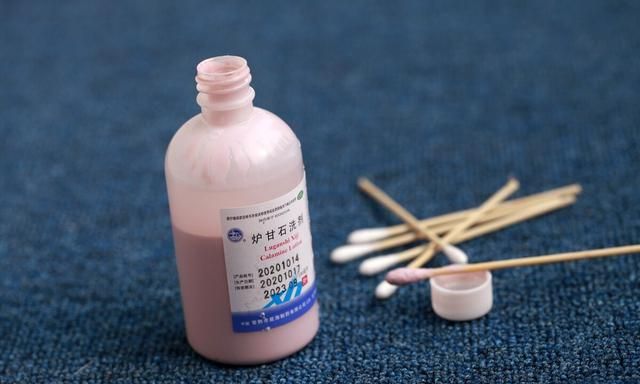 炉甘石洗剂不是万能神药，这4种情况一定不能用