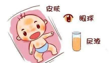 十个宝宝九个“黄”？帮您了解新生儿黄疸